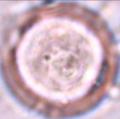 Lyc tenu 2